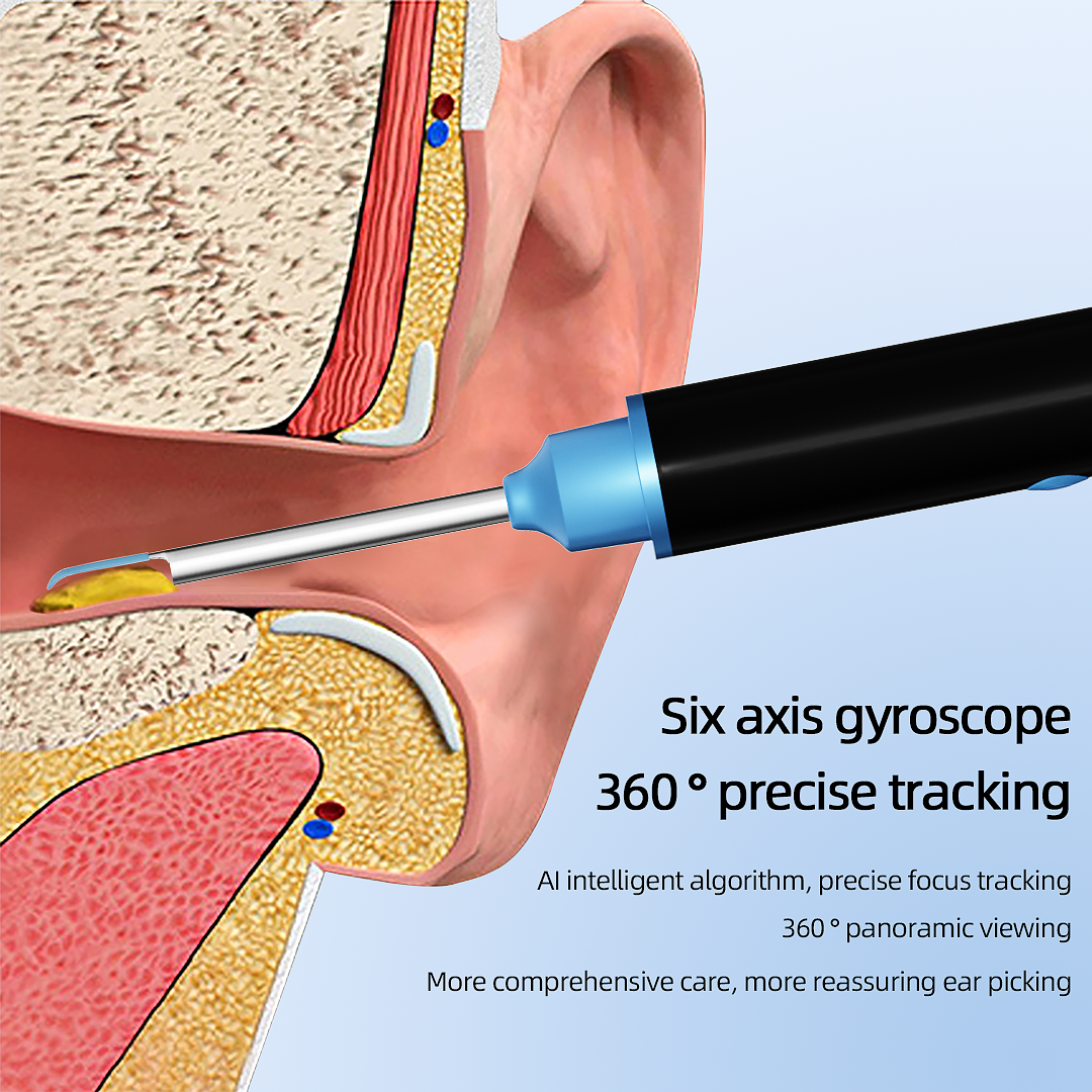 KEKOY 500W Pixel Multifunctional Endoscope Ear Wax Removal Kit Ear Cleaning Tool