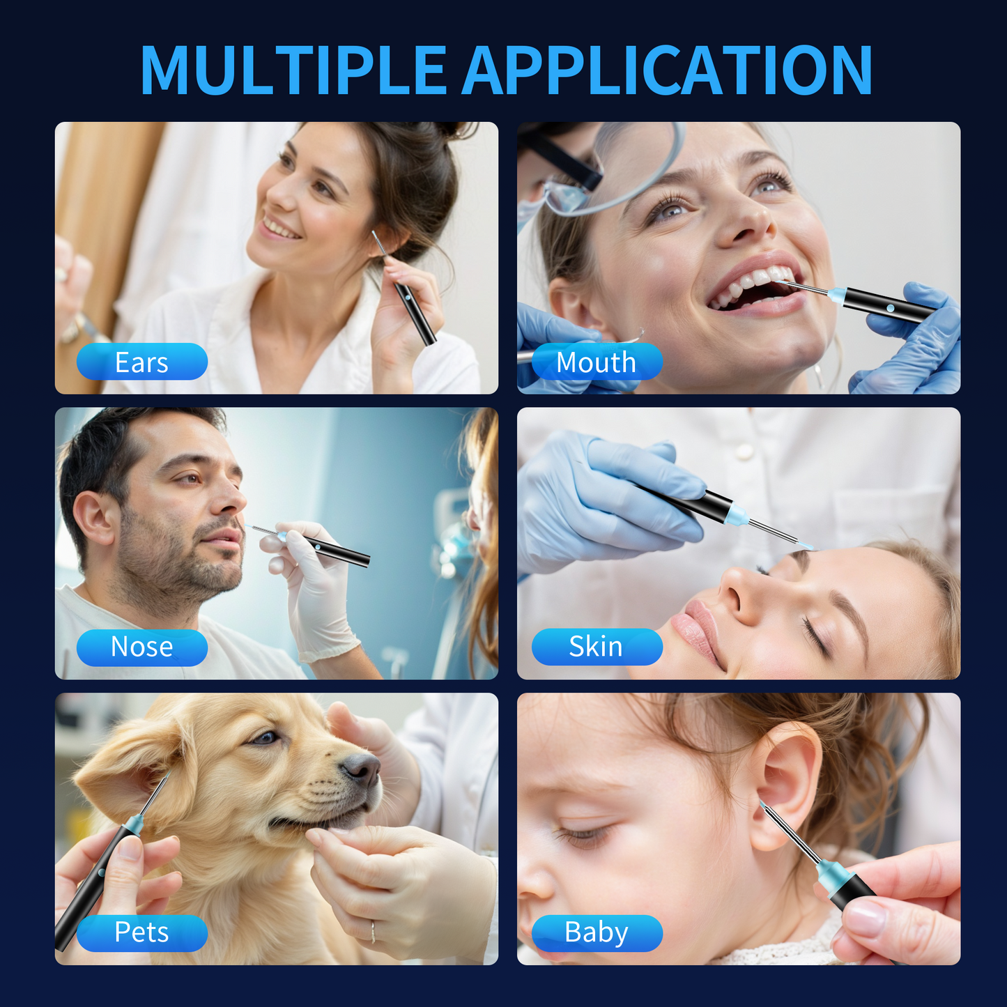 KEKOY Ear Camera and Wax Remover, 1080P Ear Wax Removal Kit, Wireless Otoscope Ear Cleaning Kit with Lights and 6 Ear Scoops