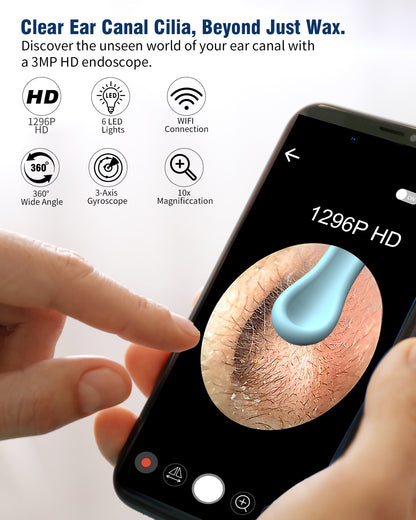 Ear Wax Removal, 1296P HD Camera, KEKOY Ear Cleaner Wireless Ear Cleaning Otoscope with 13 Pcs Kit