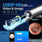 KEKOY Ear Camera and Wax Remover, 1080P Ear Wax Removal Kit, Wireless Otoscope Ear Cleaning Kit with Lights and 6 Ear Scoops