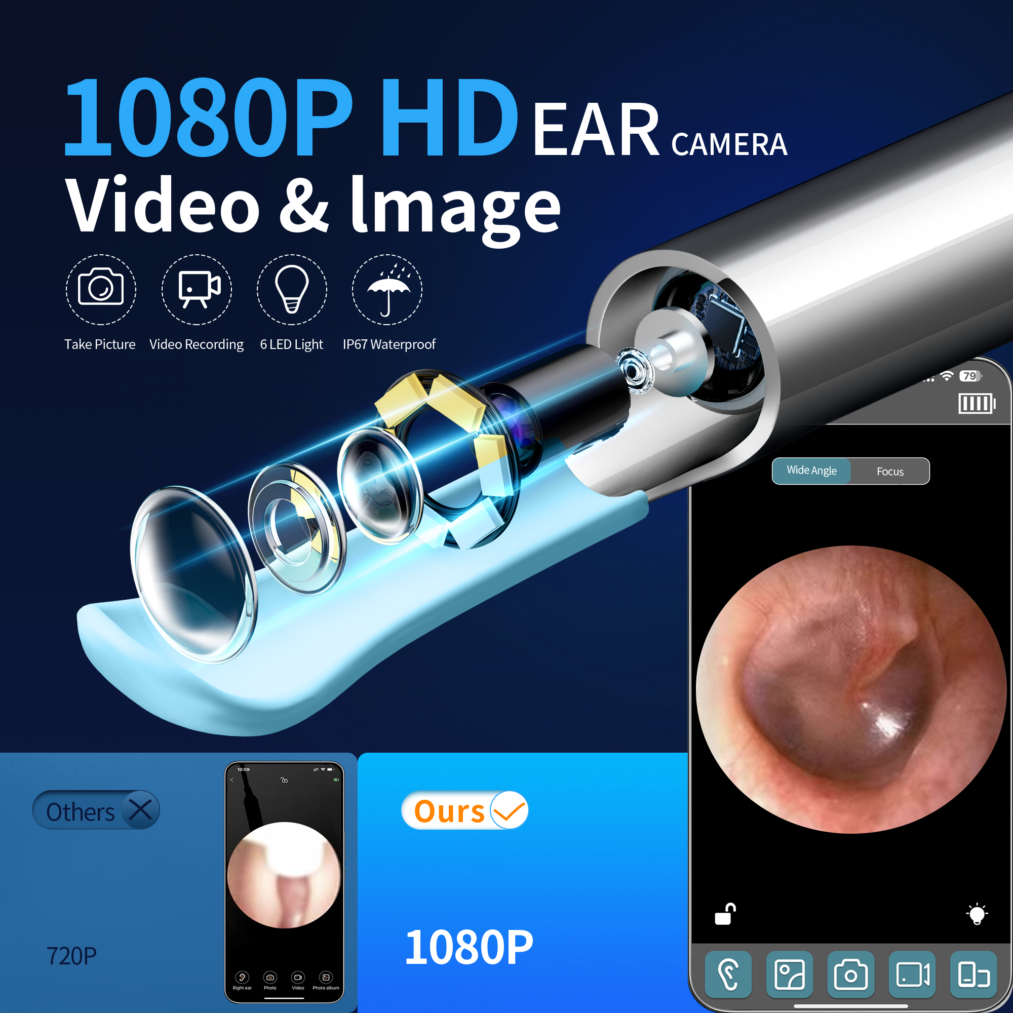 KEKOY Ear Camera and Wax Remover, 1080P Ear Wax Removal Kit, Wireless Otoscope Ear Cleaning Kit with Lights and 6 Ear Scoops