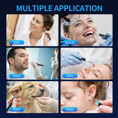 KEKOY Ear Camera and Wax Remover, 1080P Ear Wax Removal Kit, Wireless Otoscope Ear Cleaning Kit with Lights and 6 Ear Scoops